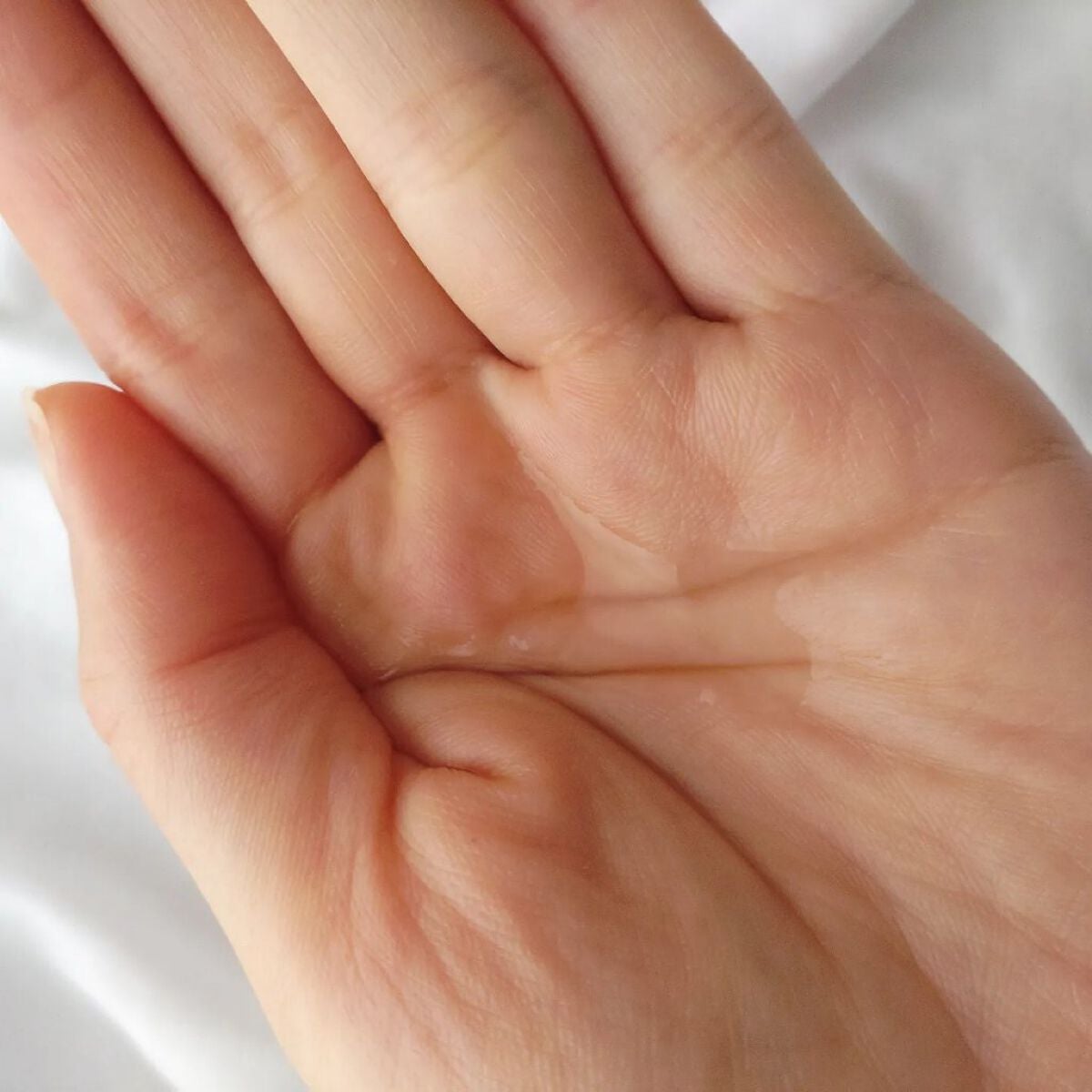 アクレオンセボエクストラクター/ANACIS/その他スキンケアを使ったクチコミ(4枚目)