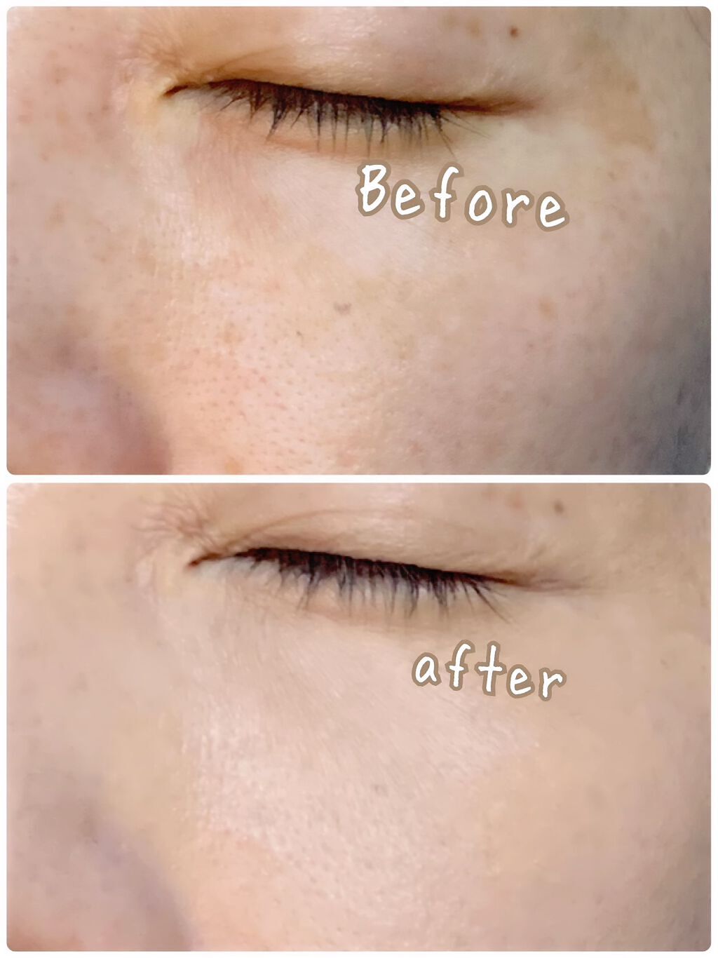 アンクル ド ポー ルクッションN/YVES SAINT LAURENT BEAUTE/クッションファンデーションを使ったクチコミ(6枚目)