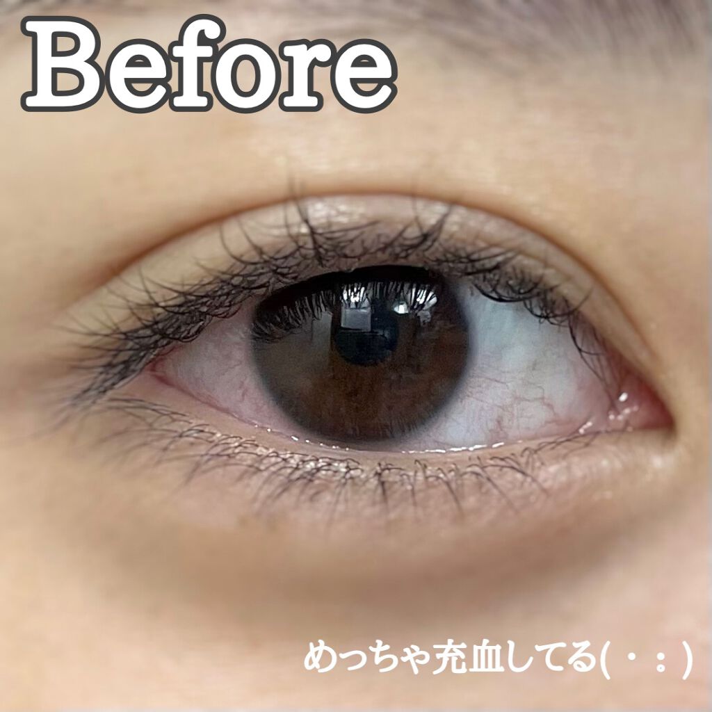 サンテ ボーティエ(医薬品)/参天製薬/その他を使ったクチコミ（2枚目）