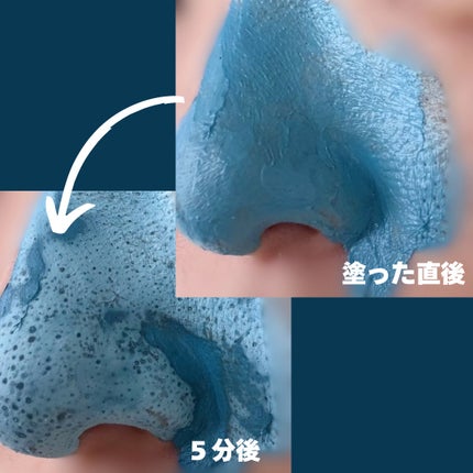 ゼロ毛穴クレイパック/MEDICUBE/洗い流すパック・マスクを使ったクチコミ(5枚目)
