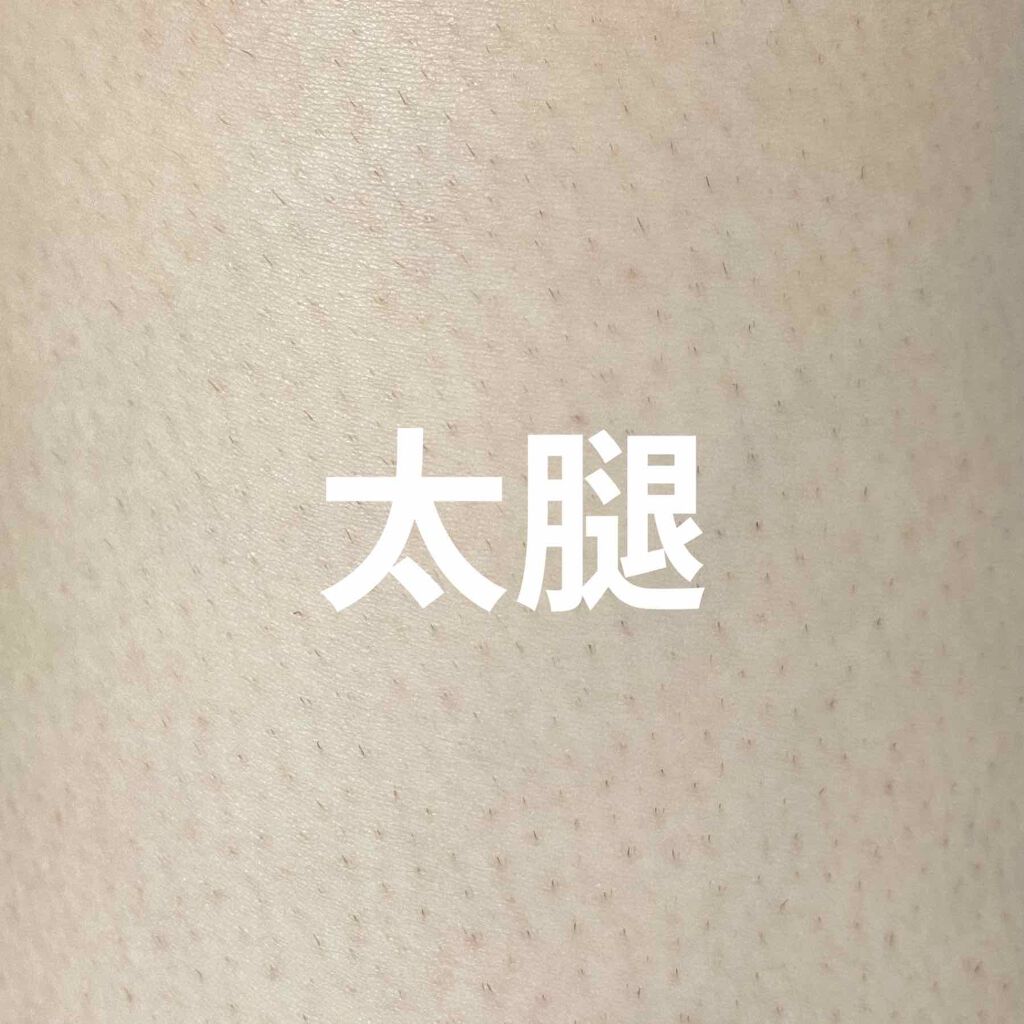 ブラウンシルクエキスパート (光美容器)/ブラウン/家庭用脱毛器を使ったクチコミ(3枚目)