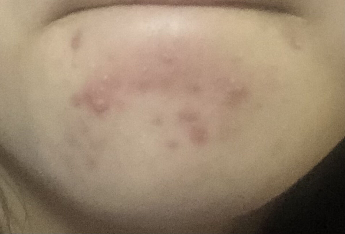 薬用しみ対策美白ジェル/メラノCC/フェイスクリームを使ったクチコミ（2枚目）