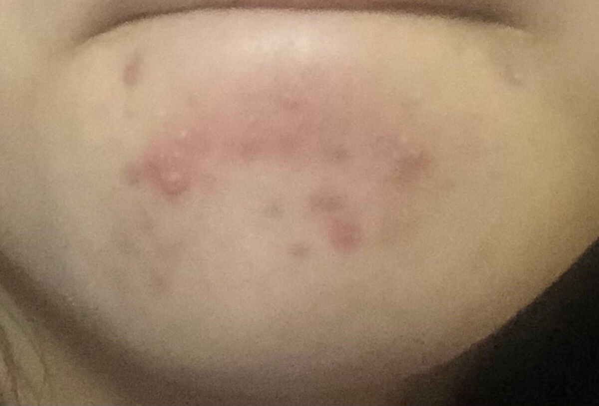 薬用しみ対策 美白化粧水/メラノCC/化粧水を使ったクチコミ(2枚目)