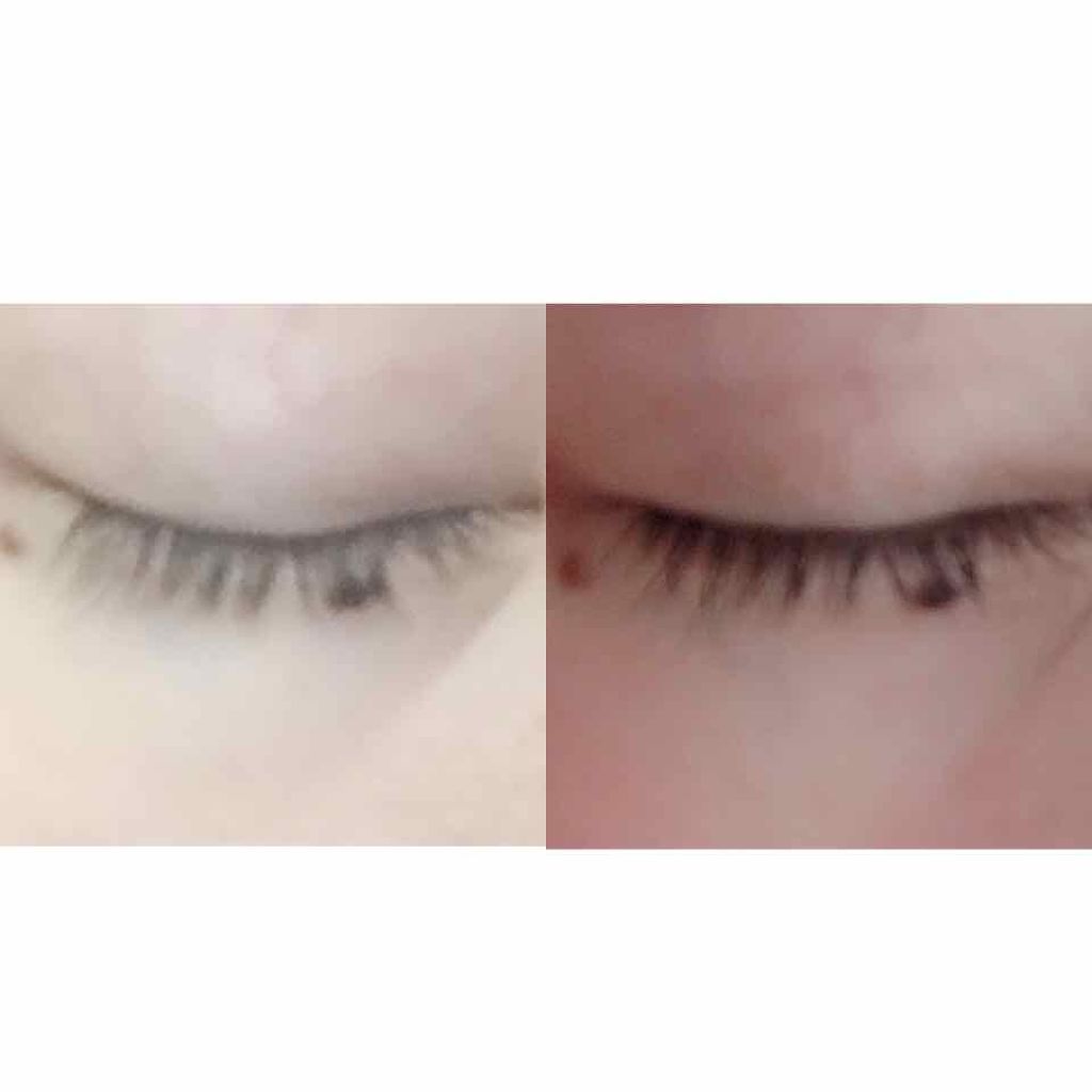 ローヤルゼリー配合 栄養ローション/DAISO/美容液を使ったクチコミ(1枚目)