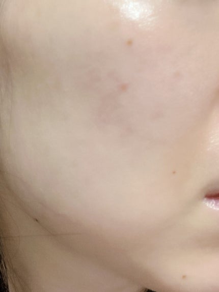 ブライトニングケア ローション M(医薬部外品)/アクアレーベル/化粧水を使ったクチコミ(2枚目)