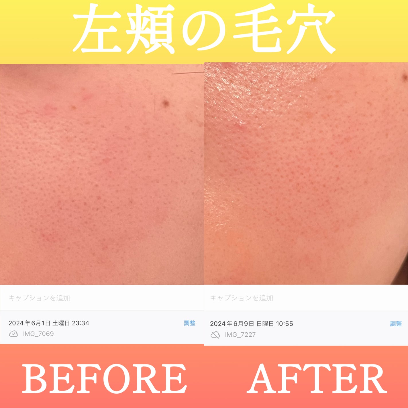 毛穴フォーカスVC VC3エッセンス/pdc/美容液を使ったクチコミ(3枚目)