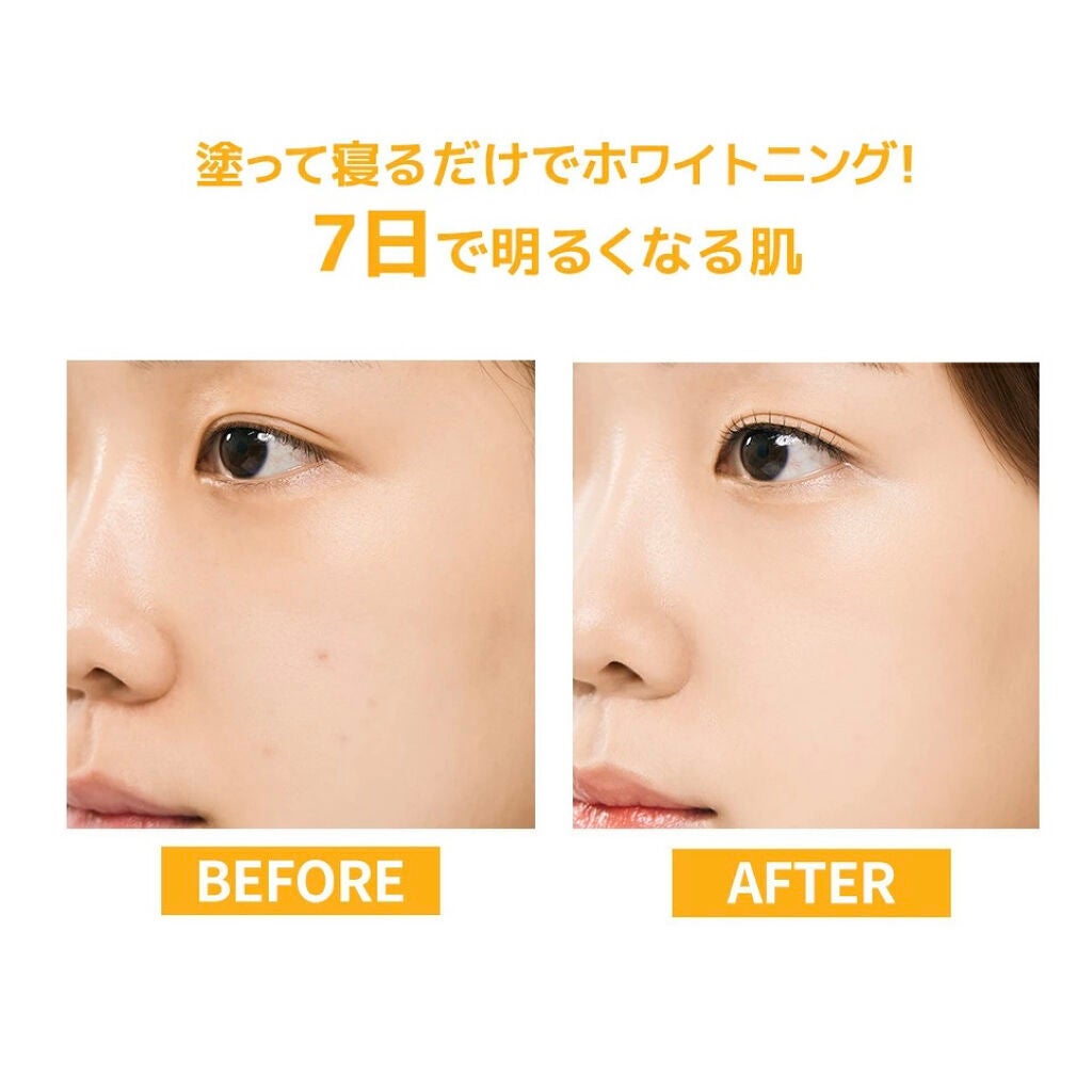 ビタペアC 集中美容液スペシャルセット/ネイチャーリパブリック/美容液を使ったクチコミ(6枚目)