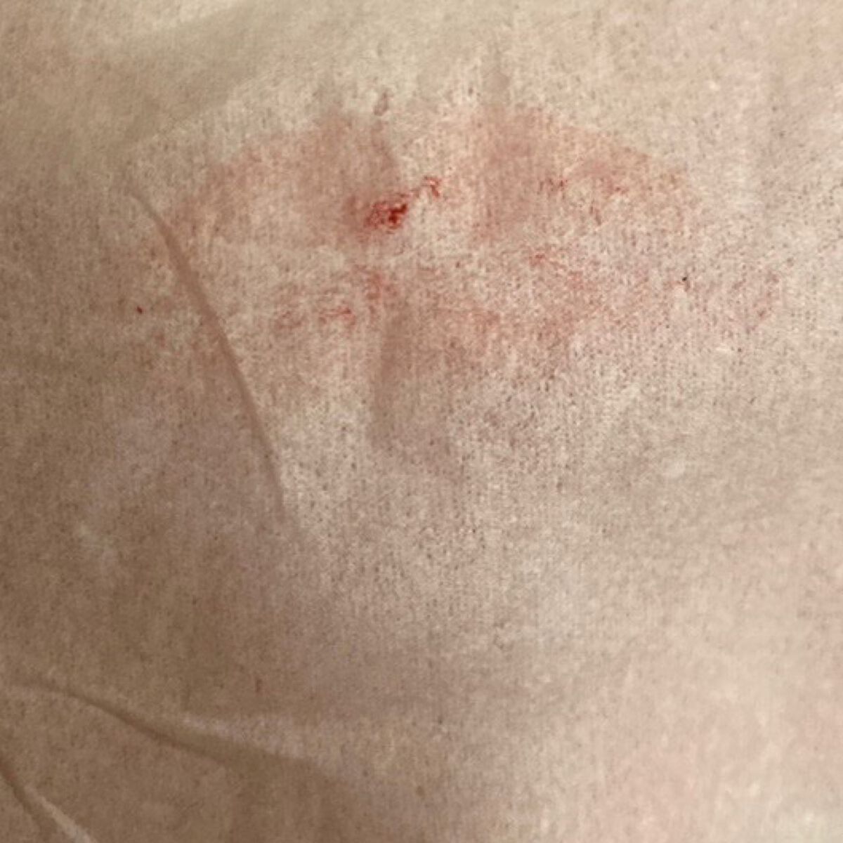 デュオ ザ クレンジングバーム ブラックリペア /DUO/クレンジングバームを使ったクチコミ（3枚目）