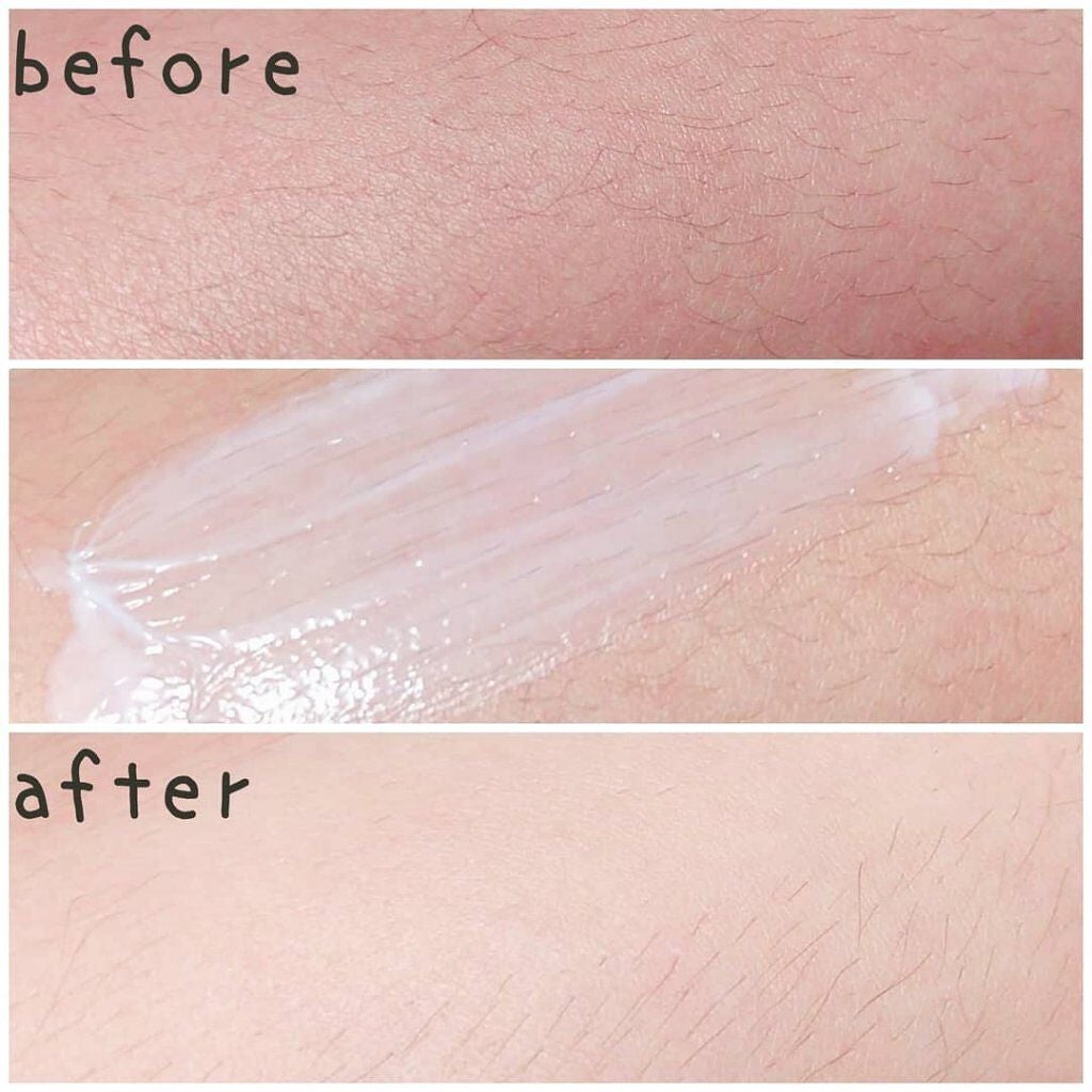 NONON/NONON(ノンノン)/除毛クリームを使ったクチコミ(6枚目)