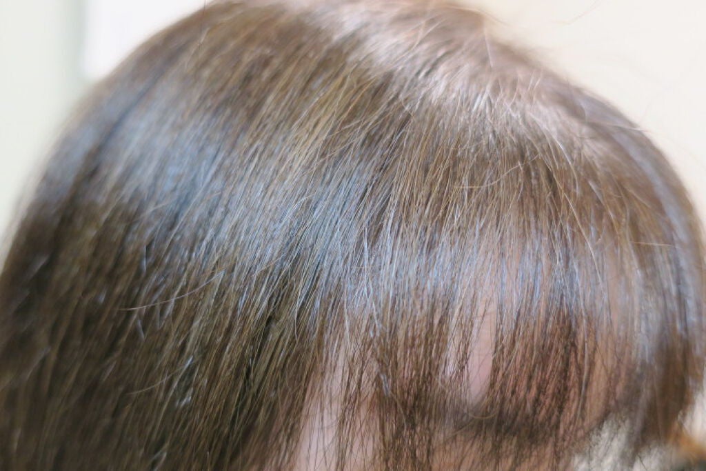 I.D メソッド モイスチュア シェイキング ヘアオイル/コーセー ビューティー ネクスト/ヘアオイルを使ったクチコミ(4枚目)