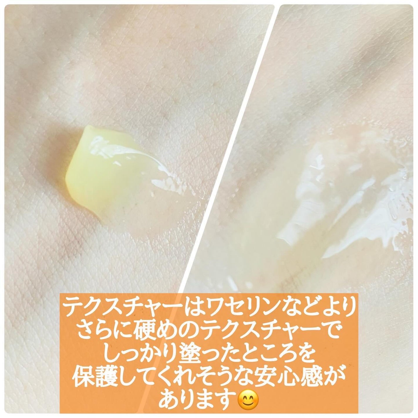 Purelane ピュアレーン100/メデラ/ボディクリームを使ったクチコミ(3枚目)