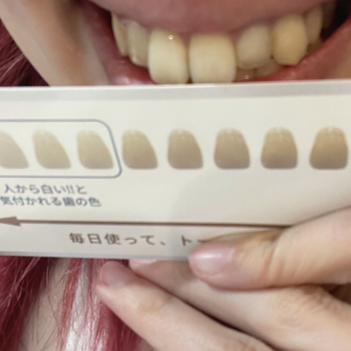 ãã¯ã€ãã£ãšãã»ã³ã¹/MiiS/ãã®ä»ãªãŒã©ã«ã±ã¢ã䜿ã£ãã¯ãã³ãïŒ3æç®ïŒ