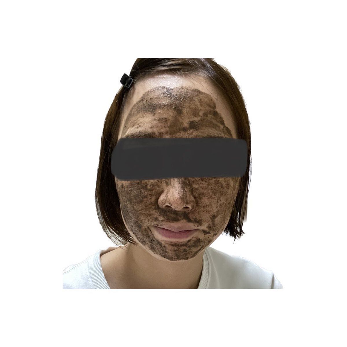 ダーマスキンピーリング/BQCELL/その他キットセットを使ったクチコミ(4枚目)