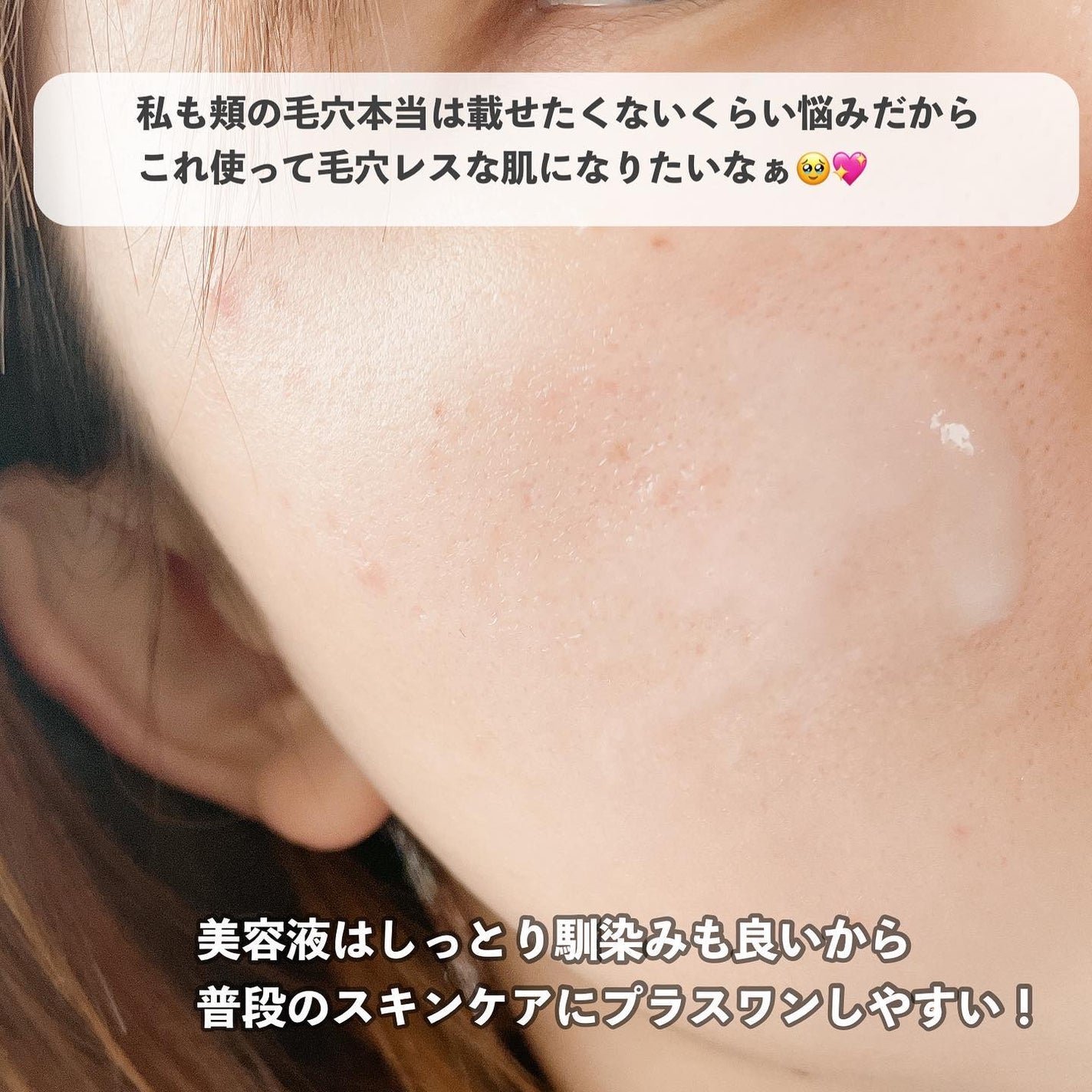 FACE FACE 薬用モイストリペアエッセンス/FACE FACE by Å P.P./美容液を使ったクチコミ(7枚目)