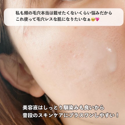 FACE FACE 薬用モイストリペアエッセンス/FACE FACE by Å P.P./美容液を使ったクチコミ(7枚目)