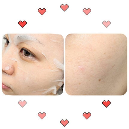 ティーツリーケア ソリューション エッセンシャルマスクEX/MEDIHEAL/シートマスク・パックを使ったクチコミ(2枚目)