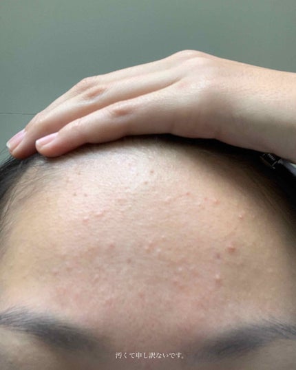 ハトムギ保湿ジェル(ナチュリエ スキンコンディショニングジェル)/ナチュリエ/美容液を使ったクチコミ(3枚目)