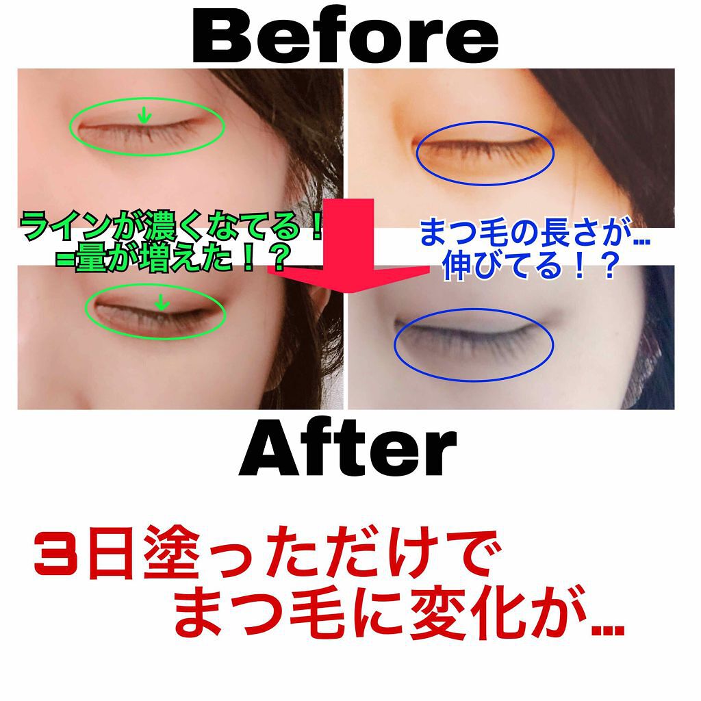 ローヤルゼリー配合 栄養ローション/DAISO/美容液を使ったクチコミ(3枚目)