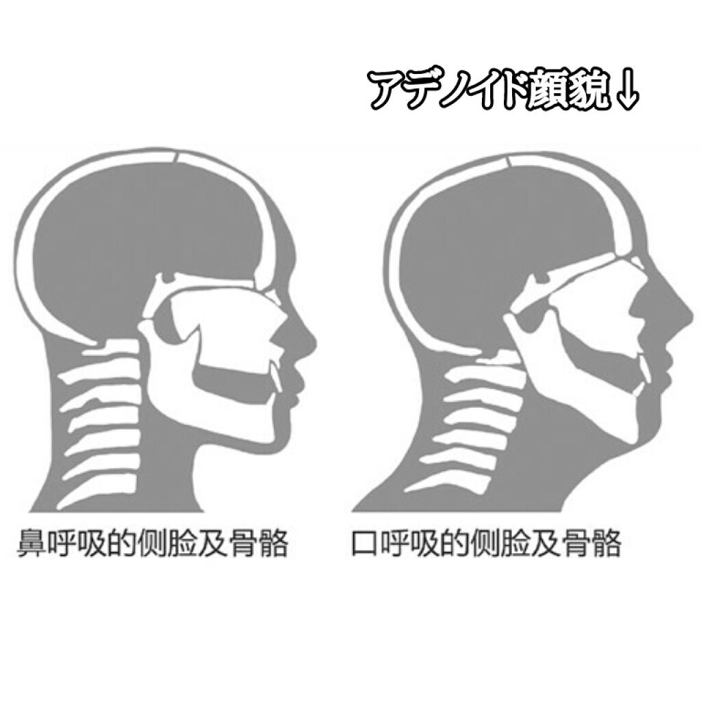 安眠マウステープ/DAISO/その他を使ったクチコミ(2枚目)