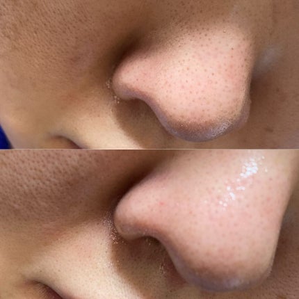 デュオ ザ クレンジングバーム/DUO/クレンジングバームを使ったクチコミ(3枚目)