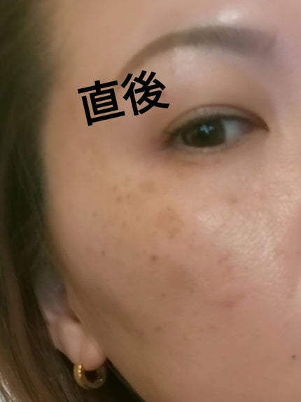 を使ったクチコミ(2枚目)