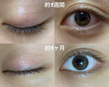 肌潤改善アイクリーム 米肌の効果に関する口コミ 米肌の アイクリームの実力は 以前も書 By Momo 敏感肌 代前半 Lips