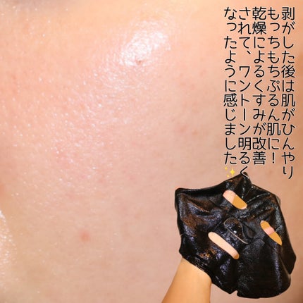 ウォーターグロウ インジェクションマスク/BANOBAGI/シートマスク・パックを使ったクチコミ(7枚目)