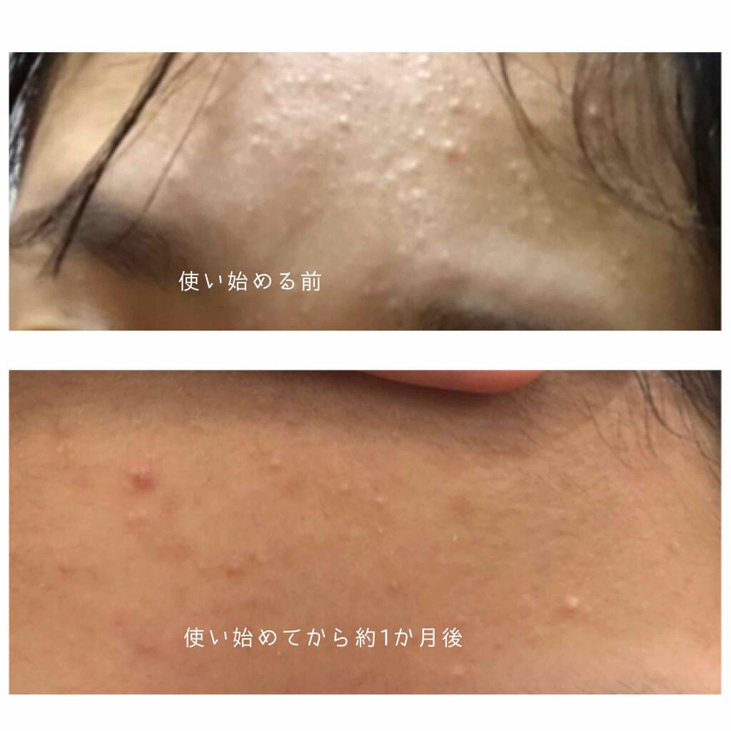 プレディア スパ・エ・メール ファンゴ W クレンズ/Prédia/クレンジングクリームを使ったクチコミ(2枚目)