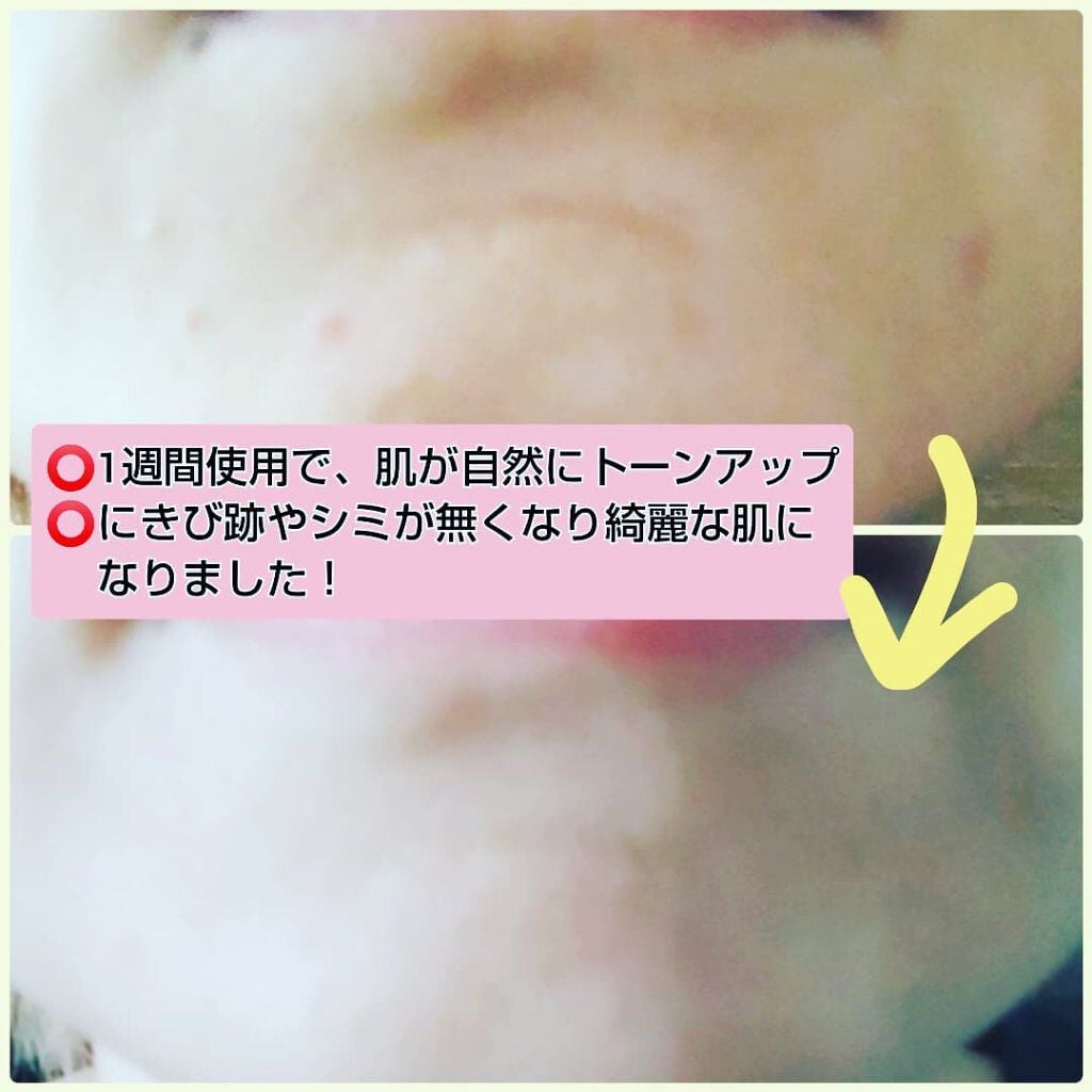 メラノフォーカスZ/HAKU/美容液を使ったクチコミ(3枚目)