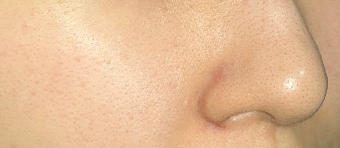 ノーモアブラックヘッド(ノーズピーリング)/One-day's you/スクラブ・ゴマージュを使ったクチコミ(6枚目)