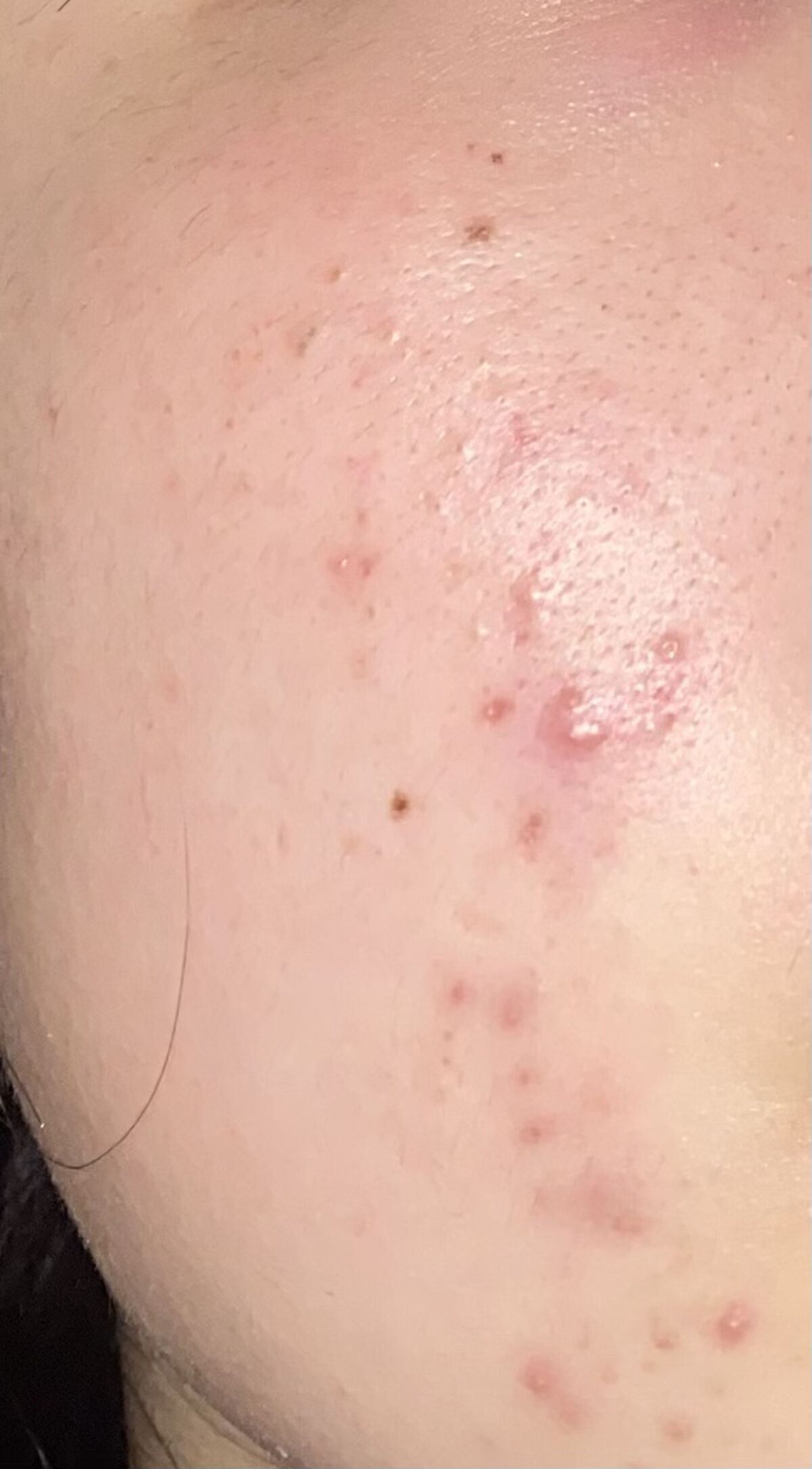 乳液・敏感肌用・しっとりタイプ/無印良品/乳液を使ったクチコミ（1枚目）