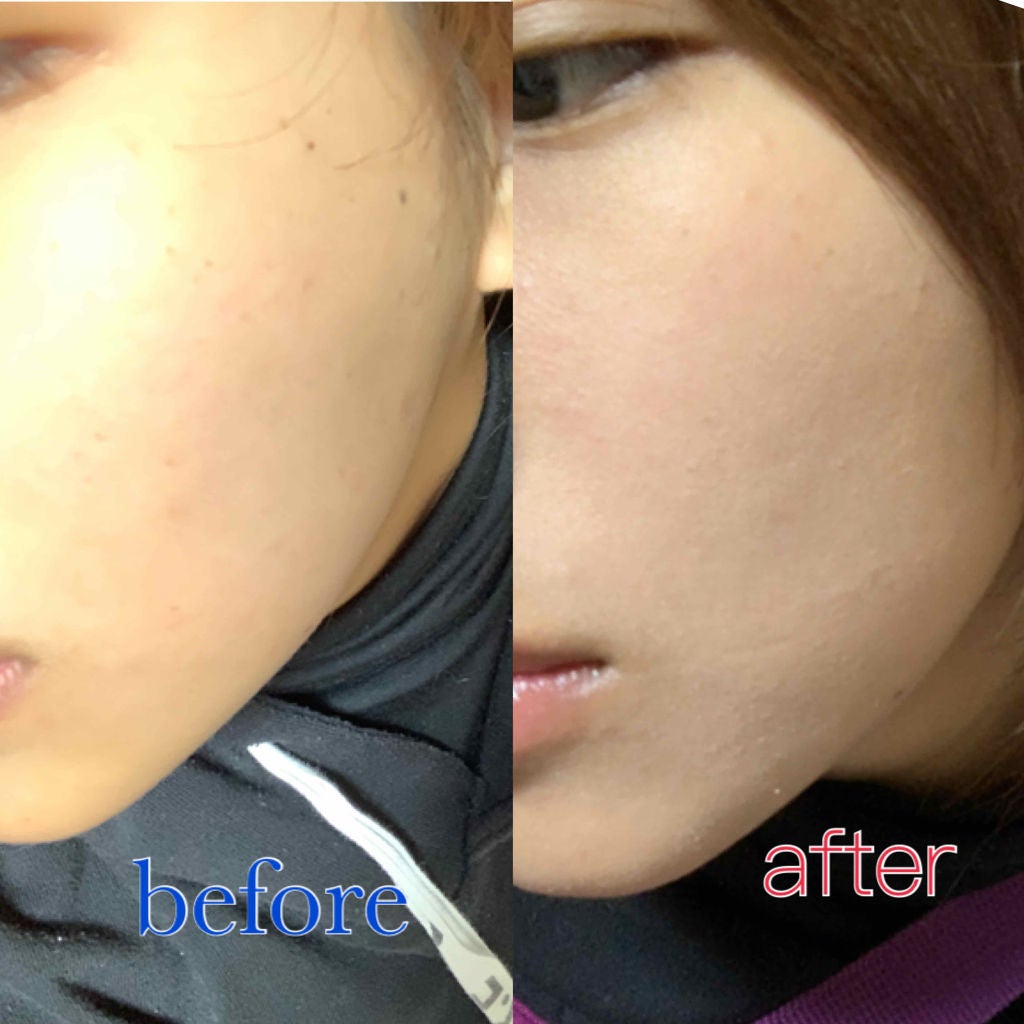 ãããã£ããã·ã¥ãªããã/ã€ã³ãã°ã¬ãŒã/ãªããããã¡ã³ããŒã·ã§ã³ã䜿ã£ãã¯ãã³ãïŒ2æç®ïŒ