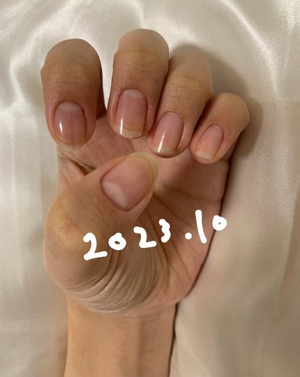 エテュセ クイックケアコート/ettusais/ネイルオイル・トリートメントを使ったクチコミ(9枚目)