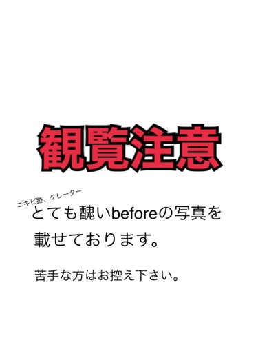 MEDICUBE AGE-R ブースタープロのクチコミ「#MEDICUBE
#AGE-R_ブースタープロ
使用して2ヶ月後のレビューです✨

本当に見.....」（2枚目）