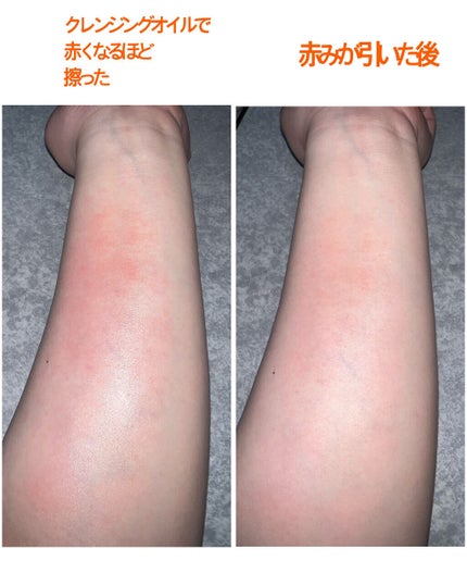 1番コフレ 星のカービィ/BANDAI SPIRITS/その他を使ったクチコミ(3枚目)