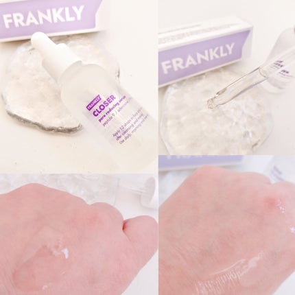 クローザーセラム/Frankly/美容液を使ったクチコミ(2枚目)