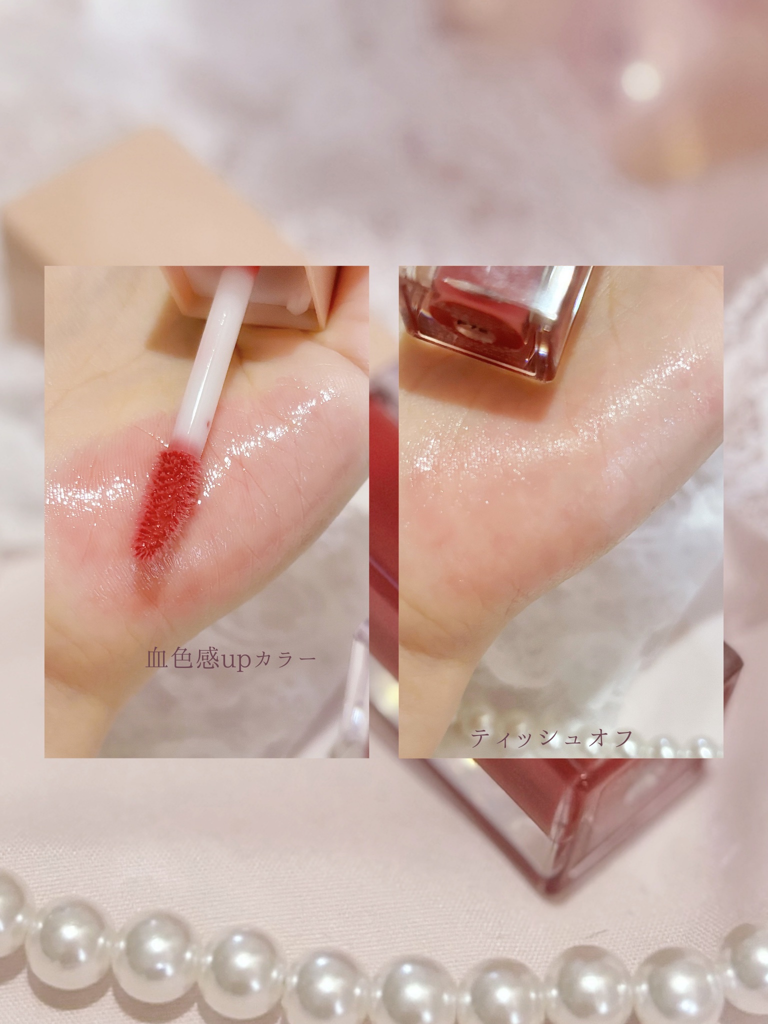 ニードルプランパー 高熱フィグ/Ui2./リッププランパーを使ったクチコミ（3枚目）