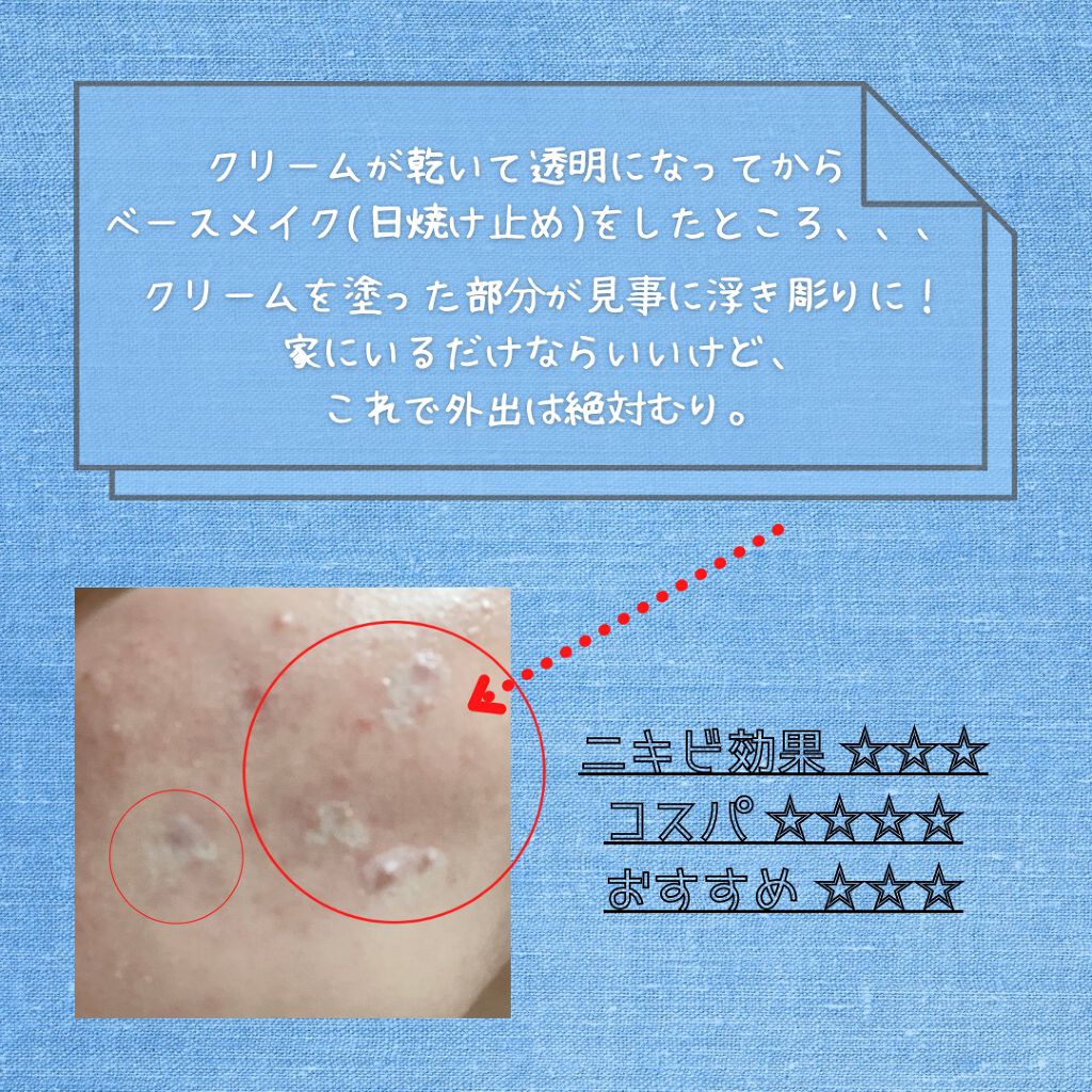 ペアアクネクリームW(医薬品)/ペア/その他を使ったクチコミ(4枚目)