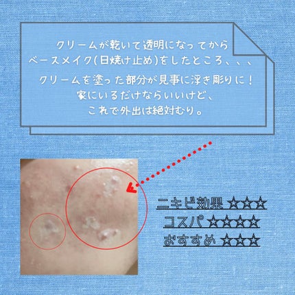 ペアアクネクリームW(医薬品)/ペア/その他を使ったクチコミ(4枚目)