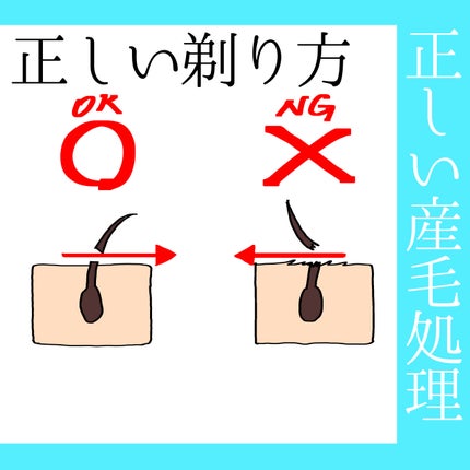 イントゥイション 敏感肌用 ホルダー (刃付き)+替刃1コ/イントゥイション/シェーバーを使ったクチコミ(4枚目)