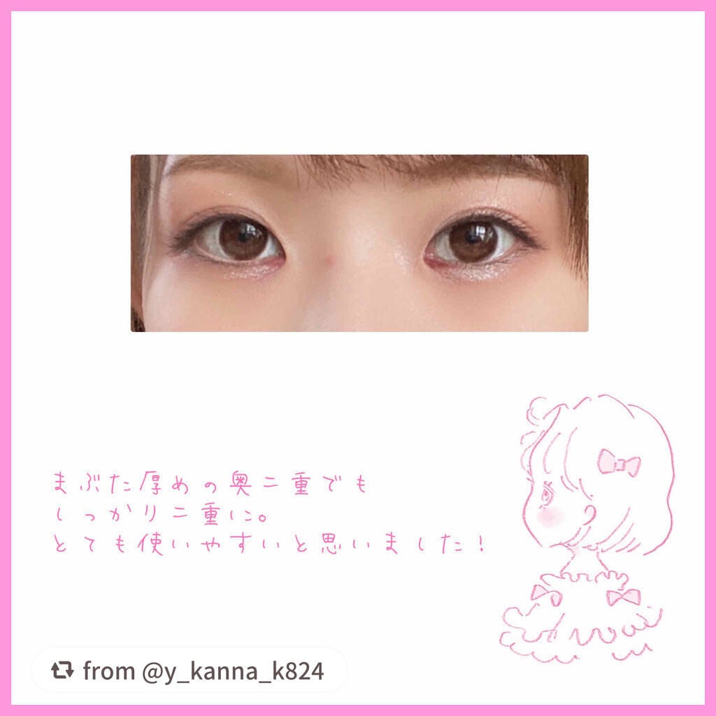 アイトーク/アイトーク/二重まぶた用アイテムを使ったクチコミ(3枚目)