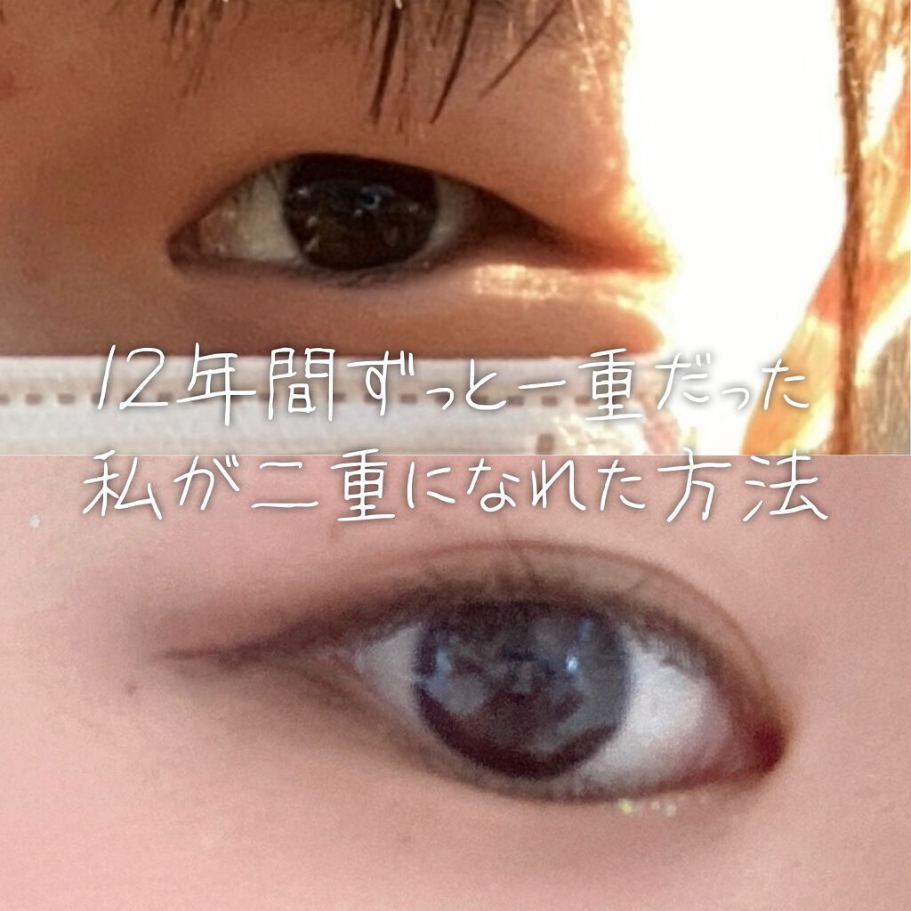 kanami on LIPS 「꒰ঌ12年間ずっと一重だった私が二重になれた方法໒꒱実は私、生..」(1枚目)