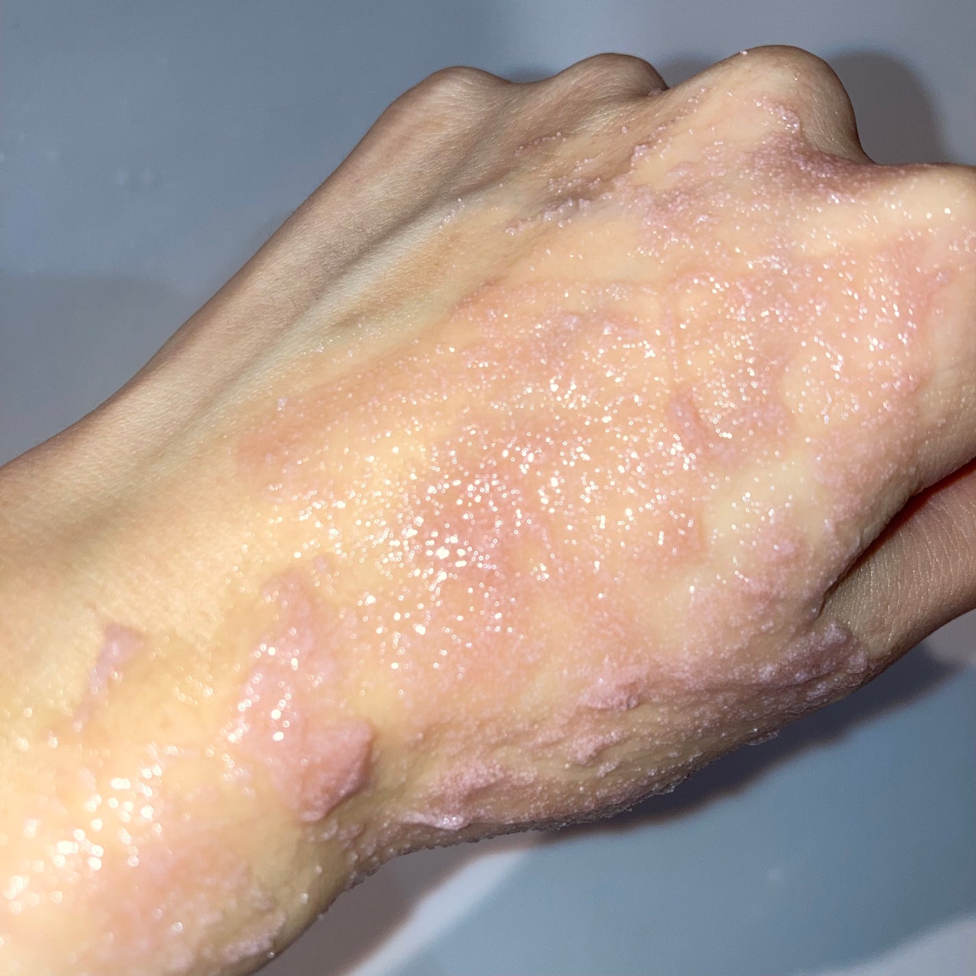 ヴィーガンパッククレンザー/WHIPPED/洗顔フォームを使ったクチコミ(5枚目)