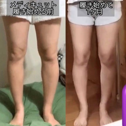 寝ながらメディキュット フルレッグ/メディキュット/着圧ソックス・レギンスを使ったクチコミ(2枚目)
