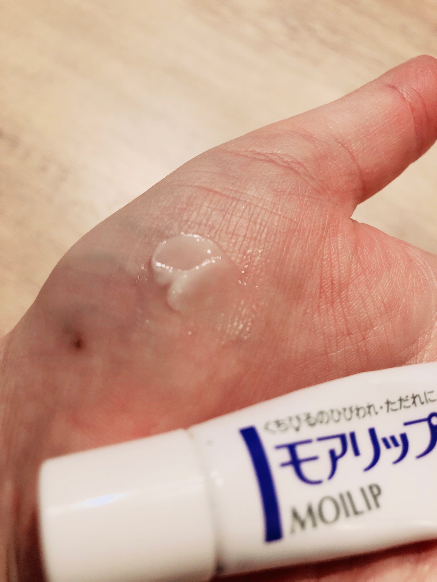 モアリップ N (医薬品)/資生堂薬品/その他を使ったクチコミ(2枚目)