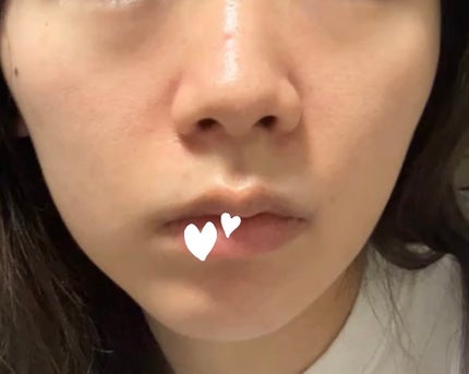 ケアセラ APフェイス&ボディ乳液/ケアセラ/ボディミルクを使ったクチコミ(3枚目)