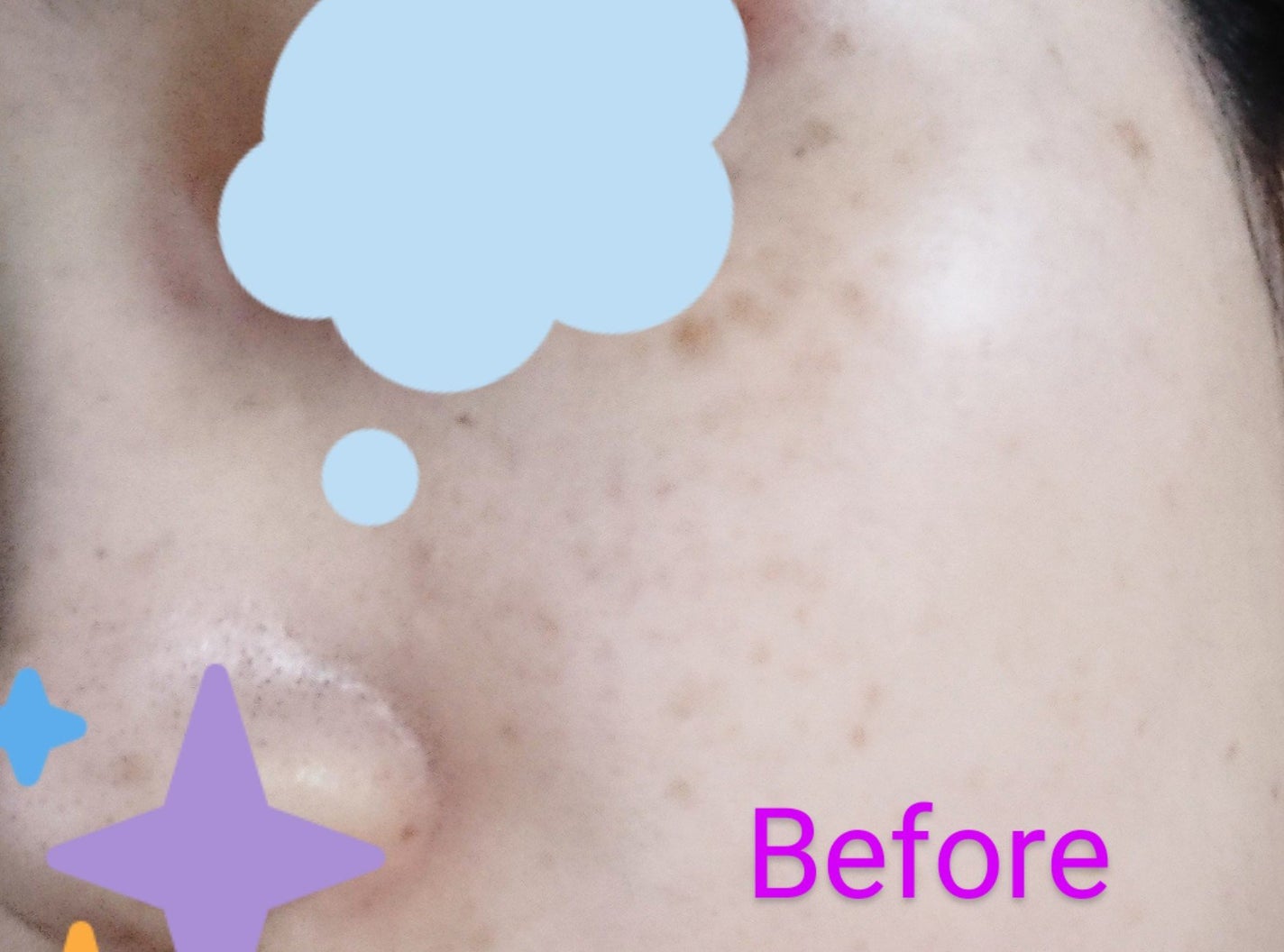 コラーゲングローブースターセラム/MEDICUBE/美容液を使ったクチコミ(6枚目)