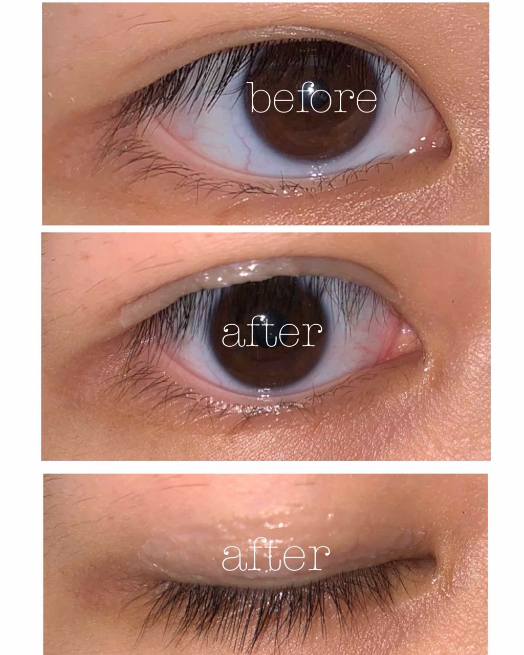 【旧品】オリシキ アイリッドスキンフィルム/D-UP/二重まぶた用アイテムを使ったクチコミ(2枚目)