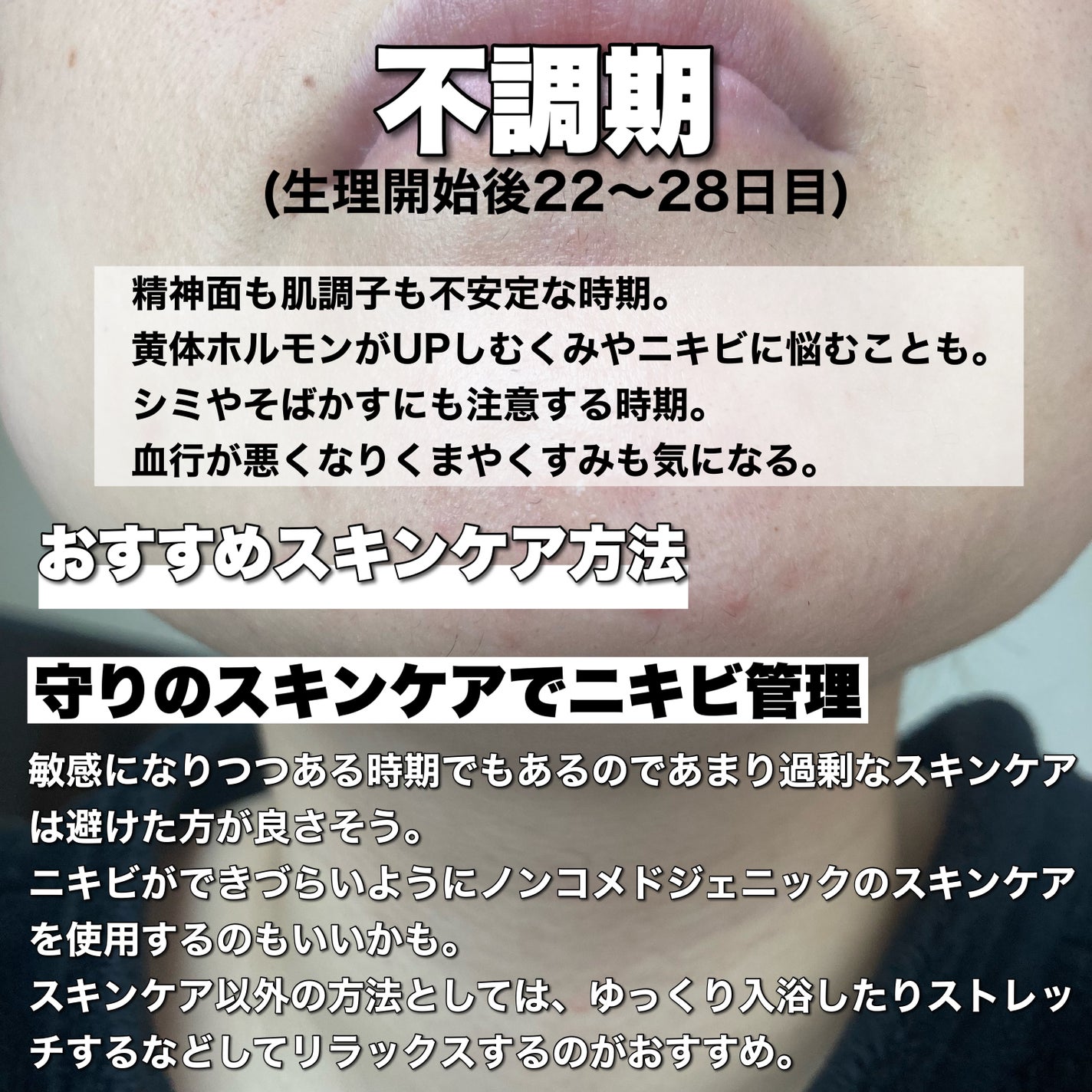 A アクネフォーム/NOV/洗顔フォームを使ったクチコミ(4枚目)