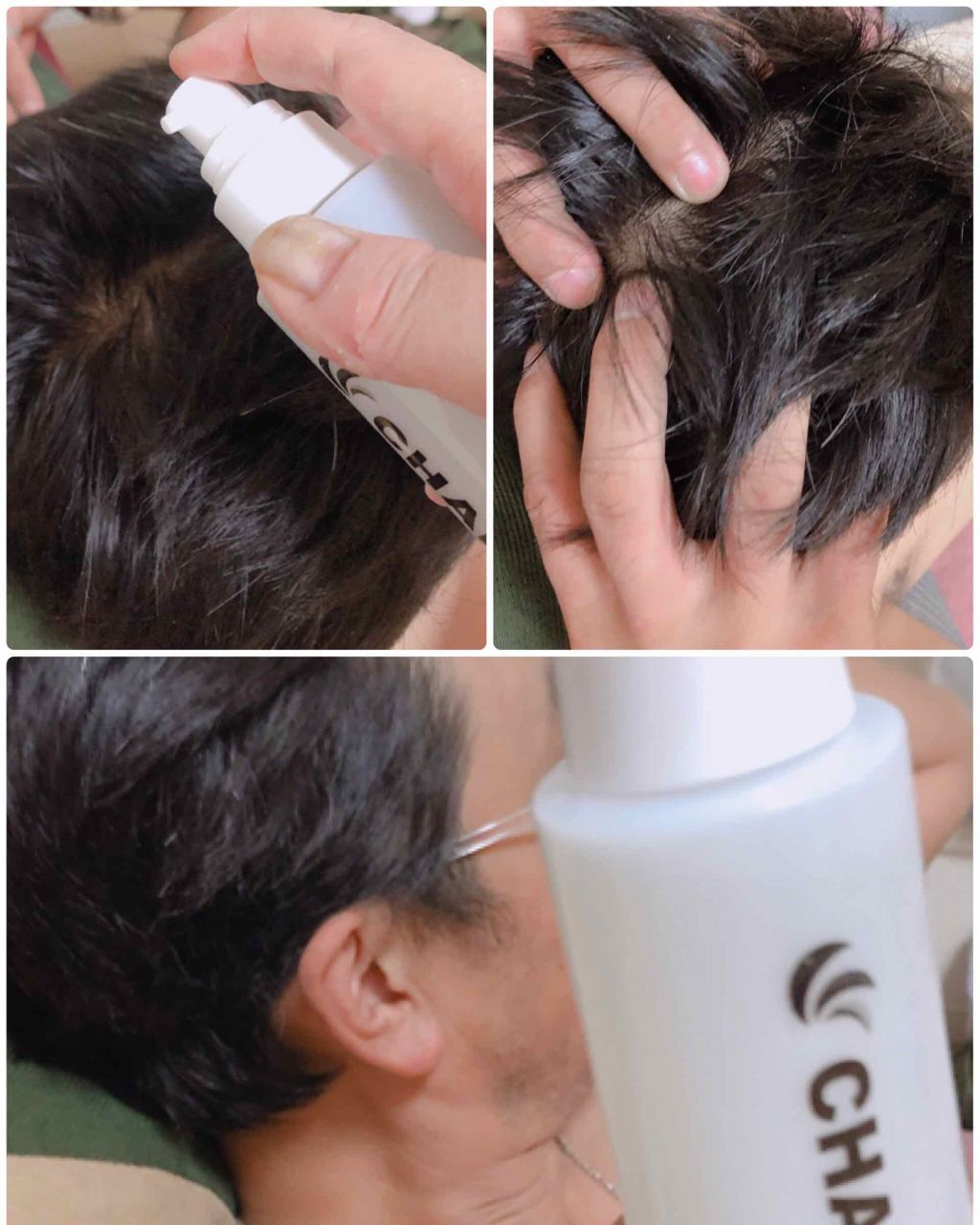 チャップアップ育毛ローション/CHAP UP(チャップアップ)/頭皮ローションを使ったクチコミ(3枚目)